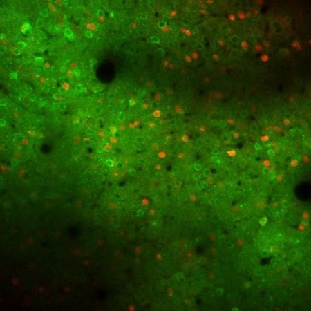 Cells in the motor cortex of mice display regions in which the neurons are active (in green) and regions in which neuron firing is inhibited (in red).